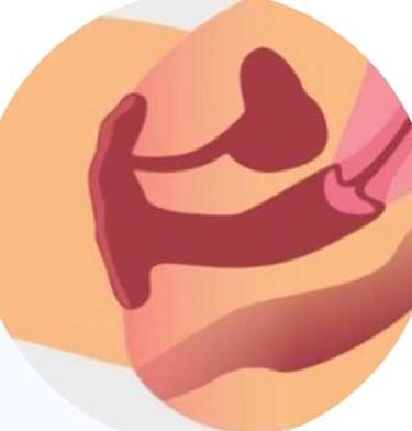 фото Схема здорової піхви