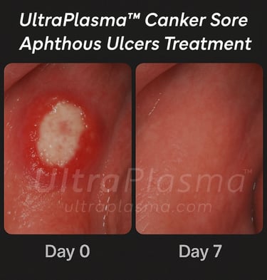 _ultra_plasma_ultra_plazma_ultra-plasma_ultra-plazma