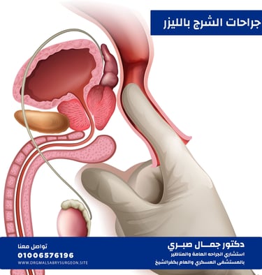 جراحــات الشرج كفرالشيخ