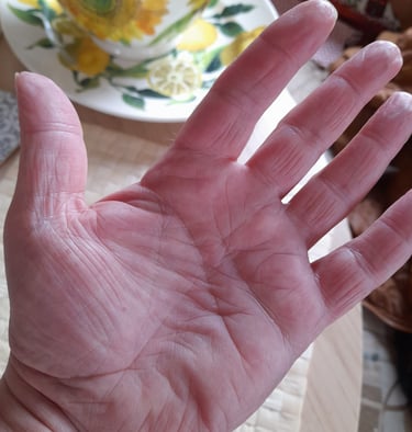 the left hand of rob hamilton showing the lines in the palm