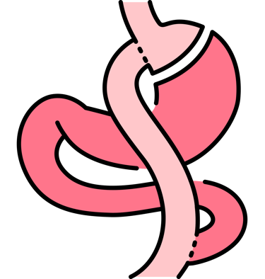 gastric bypass