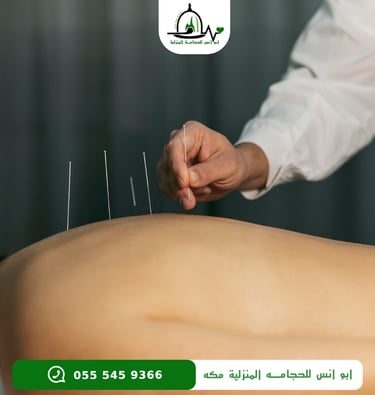 اخصائي ابر صينيه مكه