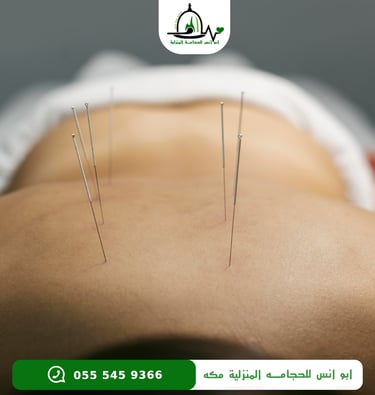 اخصائي ابر صينيه