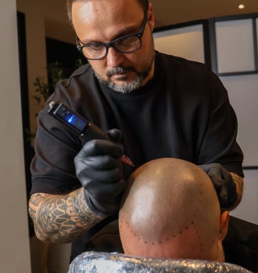 séance de micropigmentation capillaire sur quelqu'un qui a une chute de cheveux