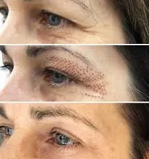 a woman with a tattoo on her forehead