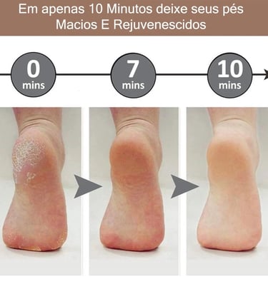 Lixador de Pé Elétrico - Esfoliador Tira Calos Pedicure Portátil