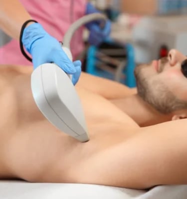 a men getting laser hair removal