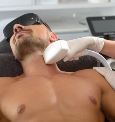 a men getting laser hair removal