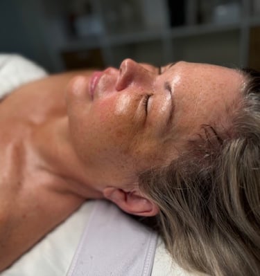The Glow after a chemical peel. Chemical peel for hyperpigmentation.