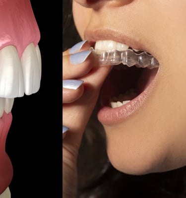 تقويم شفاف بالكويت