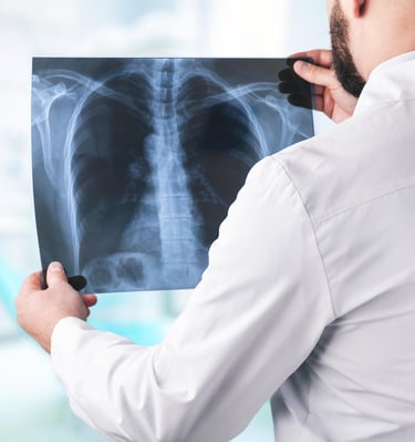 a man in a white lab coat is holding a radiograph of a chest x ray