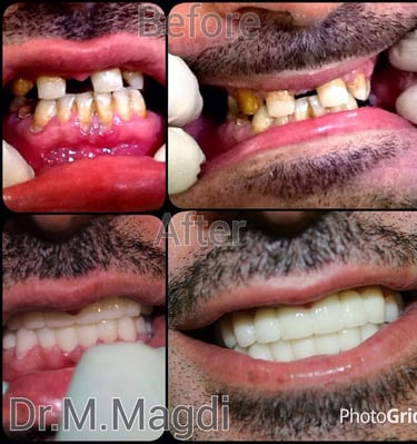 تقويم اسنان الكويت