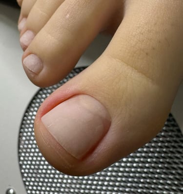 Higieninis pedikiūras