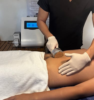 La Cavitación nos ayuda a modelar la figura al movilizar los depósitos de tejido adiposo.