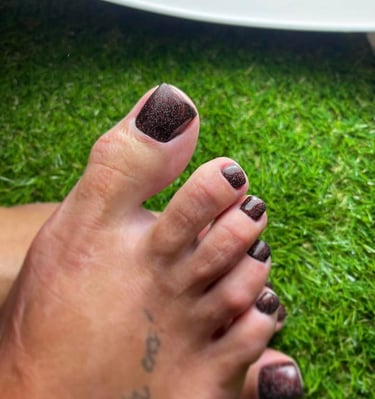 Podologas atliko aparatinį pedikiūrą ir pašalino nuospaudas