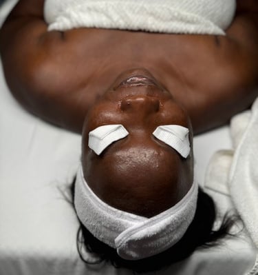 Chemical Peels to brighten and control hyperpigmentation.