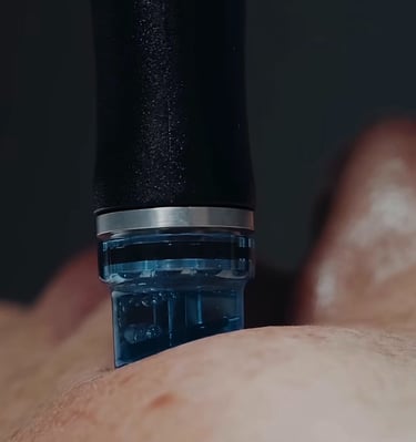 macro shot hydra facial skin treatment enlarged 