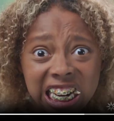 Instagram actress, Invisalyn brace girl (watch/click here)