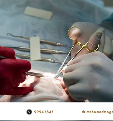 جراحة اسنان الكويت