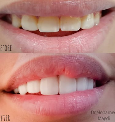 تنظيف جير في الكويت