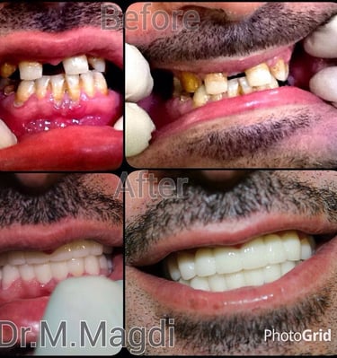 تقويم اسنان الكويت