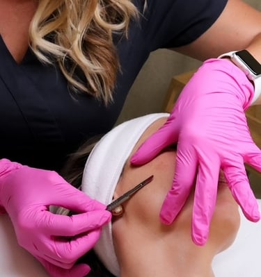 Dermaplaning