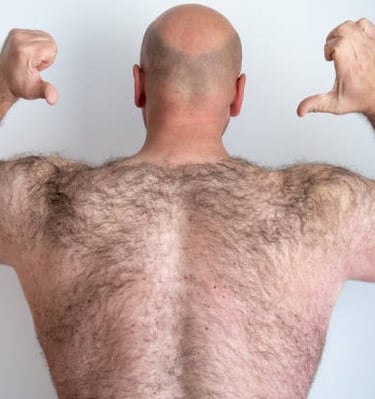 Depilação costa Masculina 