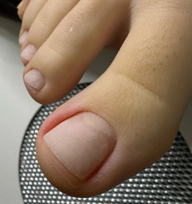 Higieninis pedikiūras