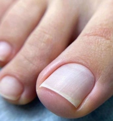 Higieninis pedikiūras