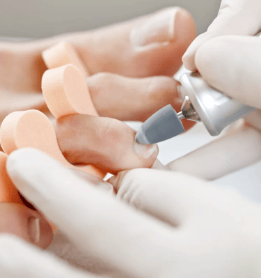 Medicininis pedikiūras 4552