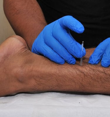 Dry needling and pain treatment in Noida, Delhi, Ghaziabad, Greater Noida