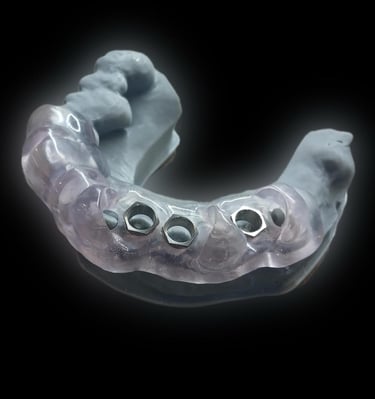 guia quirurgica para implantes dentales