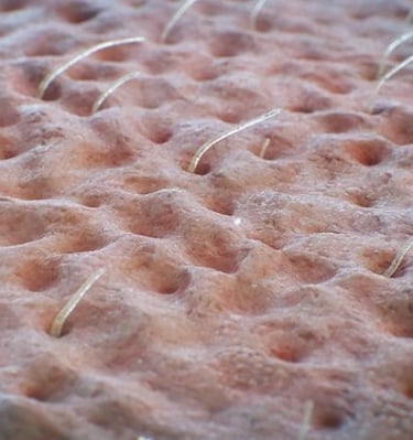 microscopic close up of part of skin with hair and pores