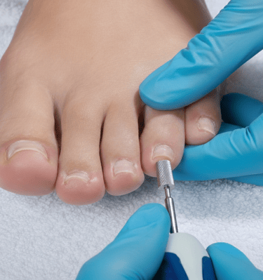 Professional podiatrist using an electric nail drill for a pedicure treatment ,fusspflege overath