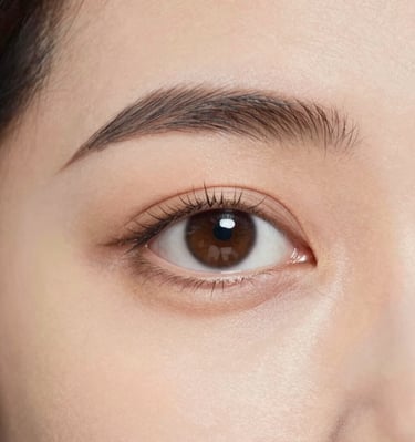 Side profile of the patient after blepharoplasty showing smooth eyelid contour