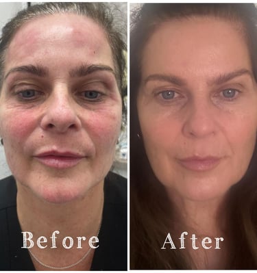 aesthetics liverpool