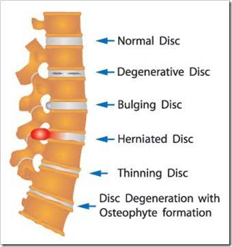 Vetrivel Health center best chiropractic and varamam theraphy 