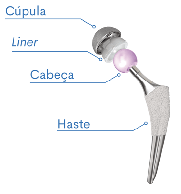 Partes de uma prótese do quadril