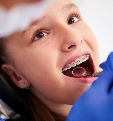 Mal-aligned teeth correction for beautiful smile at dentosculpt
