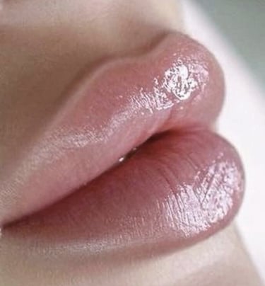 harmonização labial bh