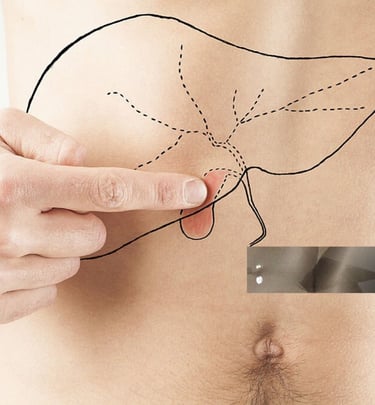 Best Gallbladder stone surgeon in Ballia Uttarpradesh 