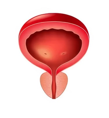 عملية استئصال البروستاتا بالتبخير