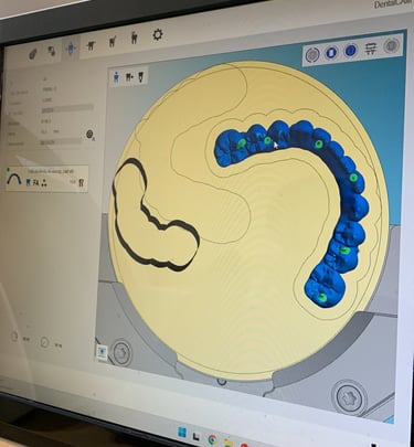 Diseño de todos nuestros casos de fija mediante CAD/CAM