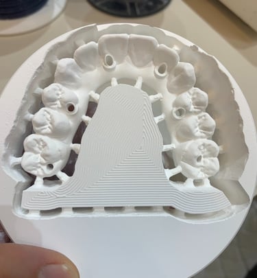 Fresado de estructuras y rehabilitación en Zirconios