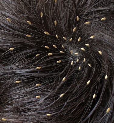 Top skin specialist and dermatologist in Vadodara offering headlice treatment and hair care services