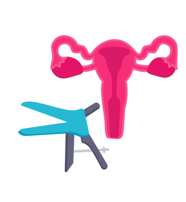 utérus et dépistage du cancer, la sage femme effectue un frottis