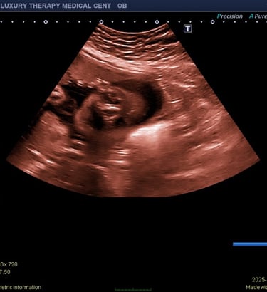 Complete OB Ultrasound in hialeah
