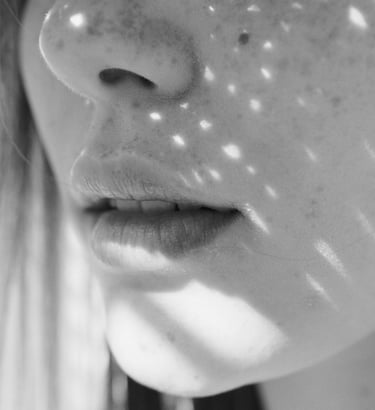 Aumentar el grosor labios con acido hialurónico y botox en Murcia. Arrugas labios tratamientos