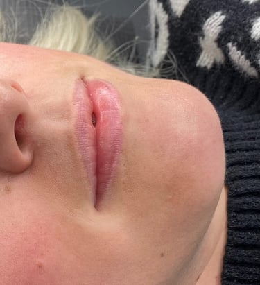 before lipblush