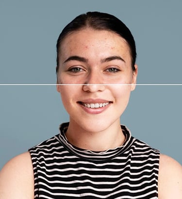 portrait-photo-blemishes-and-scars-removal
